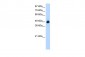 GTPBP9 antibody - N-terminal region
